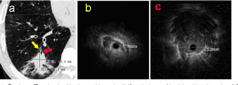 Figure From Multiple Guided Technologies Based On Radial Probe