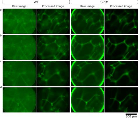 Widefield And SPIM Images Showing Improved Contrast And A Reduction Of