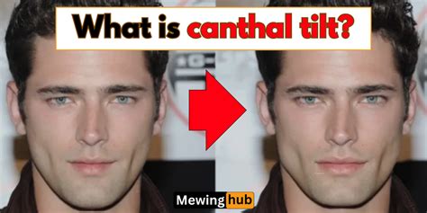 What is canthal tilt? How does it make you attractive ? – Mewinghub