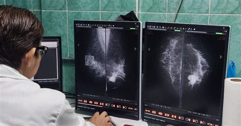 Explica IMSS Veracruz Sur beneficios de la Radiología