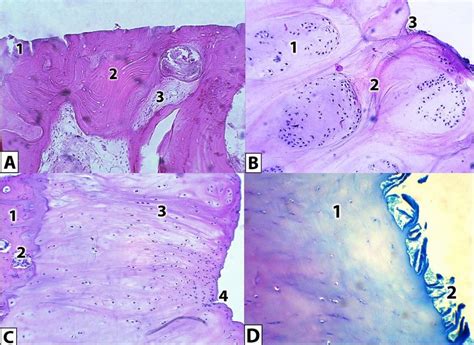 Histological Appearances Of The Medial Tibial Plateau Cartilage In