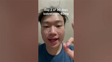 Day 2 Of 30 Days 1 Month Isotretinoin 40mg Isotretinoin Accutane Acne Jerawat Youtube