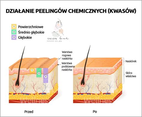 Kwasy Aha I Bha Zobacz Jak Działają Zaktualizowano Kwiecień 2024