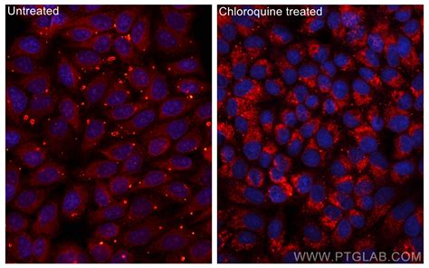 LC3 antibody (CL594-14600) | Proteintech