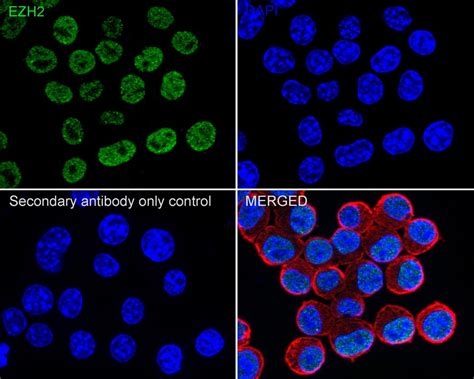 KMT6 EZH2 Recombinant Rabbit Monoclonal Antibody PSH04 14 HA722095