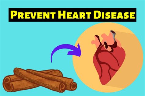 Prevent Heart Disease With These 6 Amazing Foods