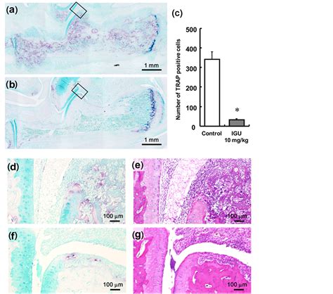 Iguratimod A Disease Modifying Anti Rheumatic Drug Inhibits