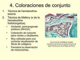 Principales Tinciones En El Laboratorio De Anatom A Patol Gica Ppt