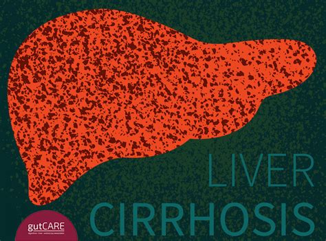 Cirrhosis Of The Liver Gutcare