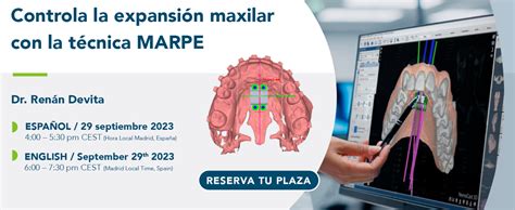 Masterclass Controla La Expansi N Maxilar Con La T Cnica Marpe Nemotec