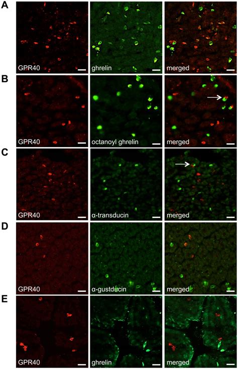 A Double Immunofluorescence Staining Showing Colocalization Between Download Scientific