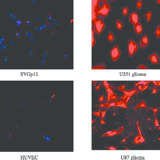 Uptake Of IL 13 Conjugated Rhodamine Labeled Liposomes In Human Cell