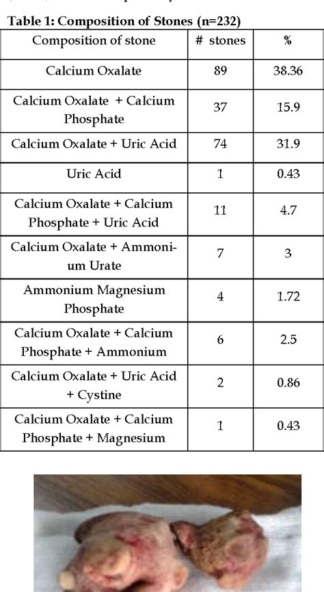 PDF Spectrum Of Renal Stones Composition Chemical Analysis Of Renal