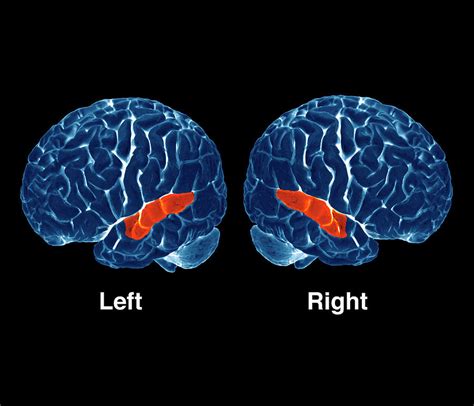 Brain Hearing Activity Photograph By Zephyr Science Photo Library Pixels