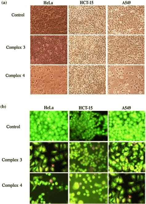 Morphological Changes Of The Cervical Hela Colon Hct And Lung