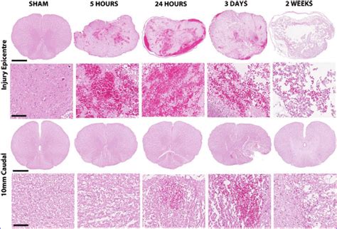 Hematoxylin And Eosin Staining Demonstrates The Morphological Changes