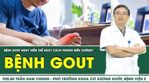 Nhận Biết Bệnh Gout Dấu Hiệu Nguyên Nhân Và Cách Phòng Ngừa