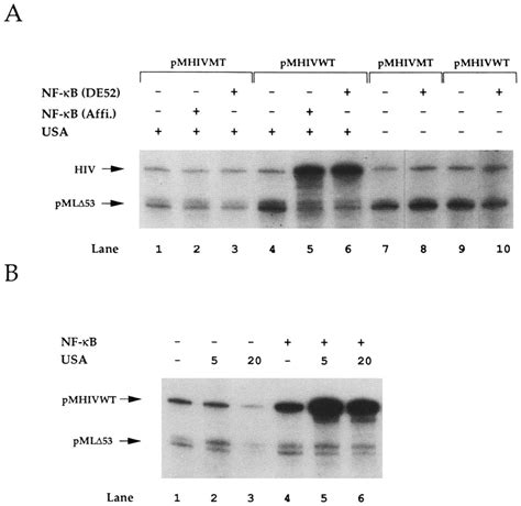 Site Specific Transcriptional Activation Of The Hiv Promoter By Nf Kb