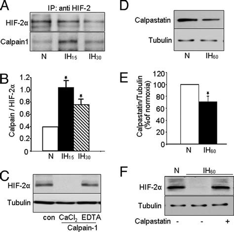 Evidence For Interactions Of HIF 2 With Calpain 1 A PC12 Cells Were