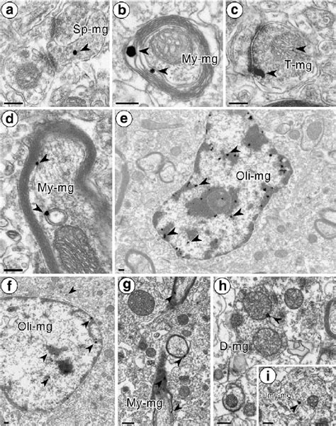 Electron Micrographs Showing Megalin Immunoreactivity In The