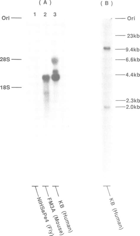 A Blot Hybridization Analysis Of Polya Rna From Various Download