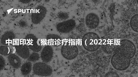 中国印发《猴痘诊疗指南（2022年版）》 2022年6月16日 俄罗斯卫星通讯社