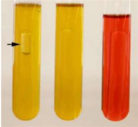 Phenol Red Glucose Lactose Test Flashcards Quizlet
