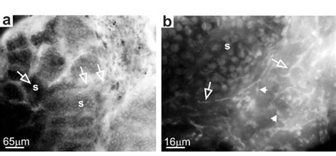 Fluorescence Photomicrographs Of Transverse Sections Of A Lingual Salt