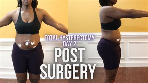 Day 2 Post Hysterectomy Recovery Laparoscopic Hysterectomy Due To