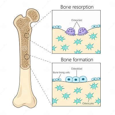 bone resorption formation diagram medical science stock illustration