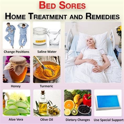 How To Treat Bed Sores At Home : 10 Remedies You Can Try ...