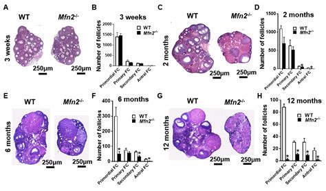 Mitofusin 2 Plays A Role In Oocyte And Follicle Development And Is