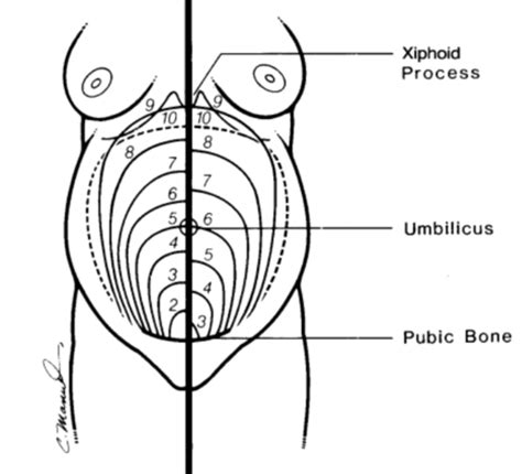 Obstetrics Flashcards Quizlet