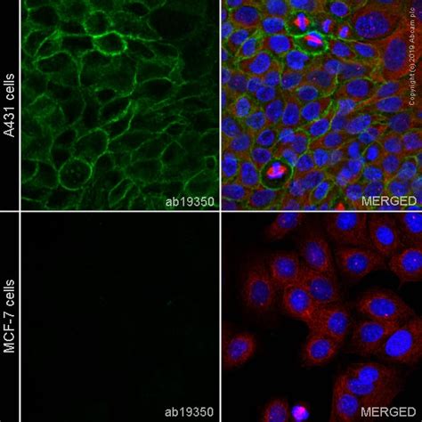 Anti P Cadherin Antibody 6A9 Ab19350 Abcam