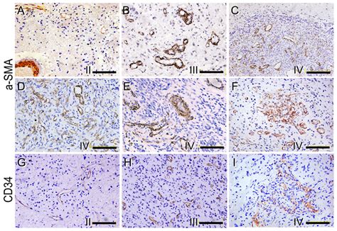 Immunohistochemical staining for α SMA A F and CD34 G I of