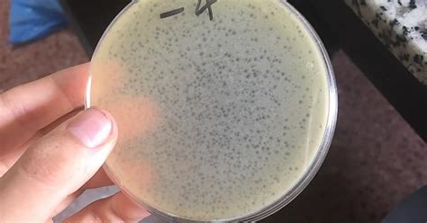 Are These Phages Lytic Or Lysogenic Album On Imgur