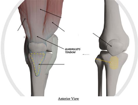 Knee Diagram Quizlet