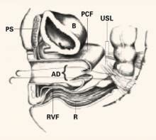 Surgical Management Of Vaginal Vault Prolapse Mdedge Obgyn