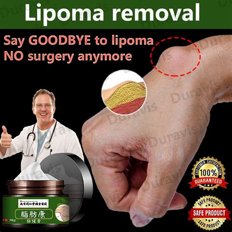 Lipoma Cream Lipoma Removal Cream Lipoma G Quickly And