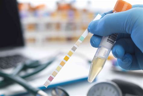 Urinalysis: Purpose, Preparation, Risks, and Results