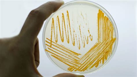 Actinomyces qué es características morfología patogenia