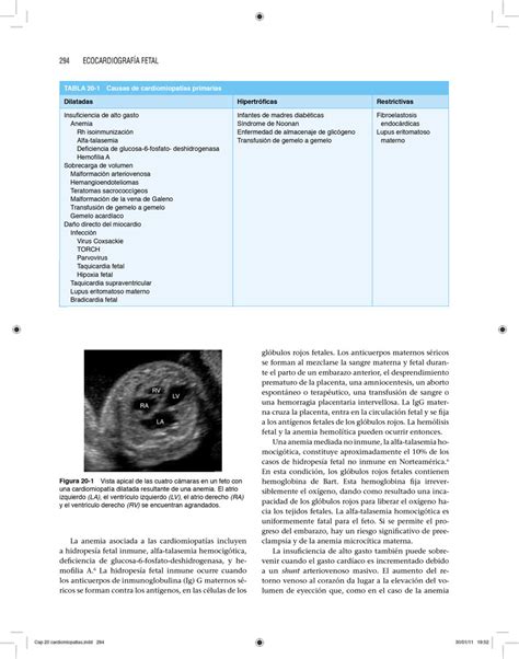 Libro Ecocardiografía Fetal 1era edición en Campus