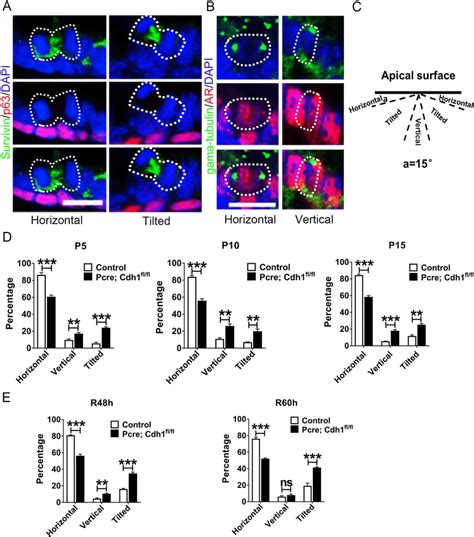 Oriented Cell Division Of Prostate Epithelial Cells During Postnatal