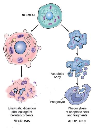 Apoptosis vs Necrosis | Medical Junction