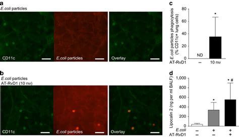 AT RvD1 Increases Bacterial Phagocytosis By CD11c Lung Cells