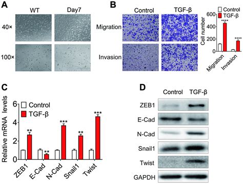 Comprehensive analysis of TGF β induced mRNAs and ncRNAs in