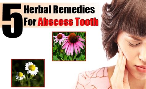 5 Best Herbal Remedies For Abscess Tooth – Natural Home Remedies ...