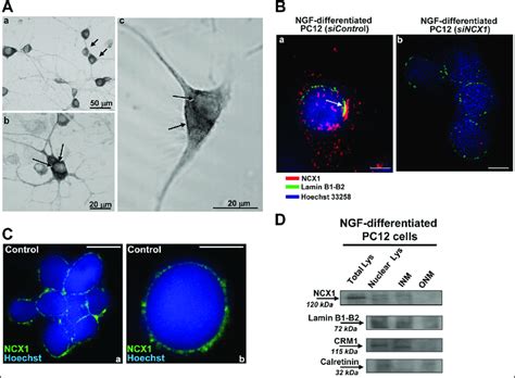 Localization Of Neuronal Na Ca Exchanger At The Inner Membrane