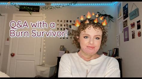 Burn Survivor Answers Your Questions! | Q&A - YouTube | Burn survivor ...