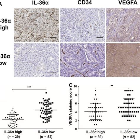 Ihc Staining Of Il‐36α Cd34 And Vegfa In Patients With Nsclc A